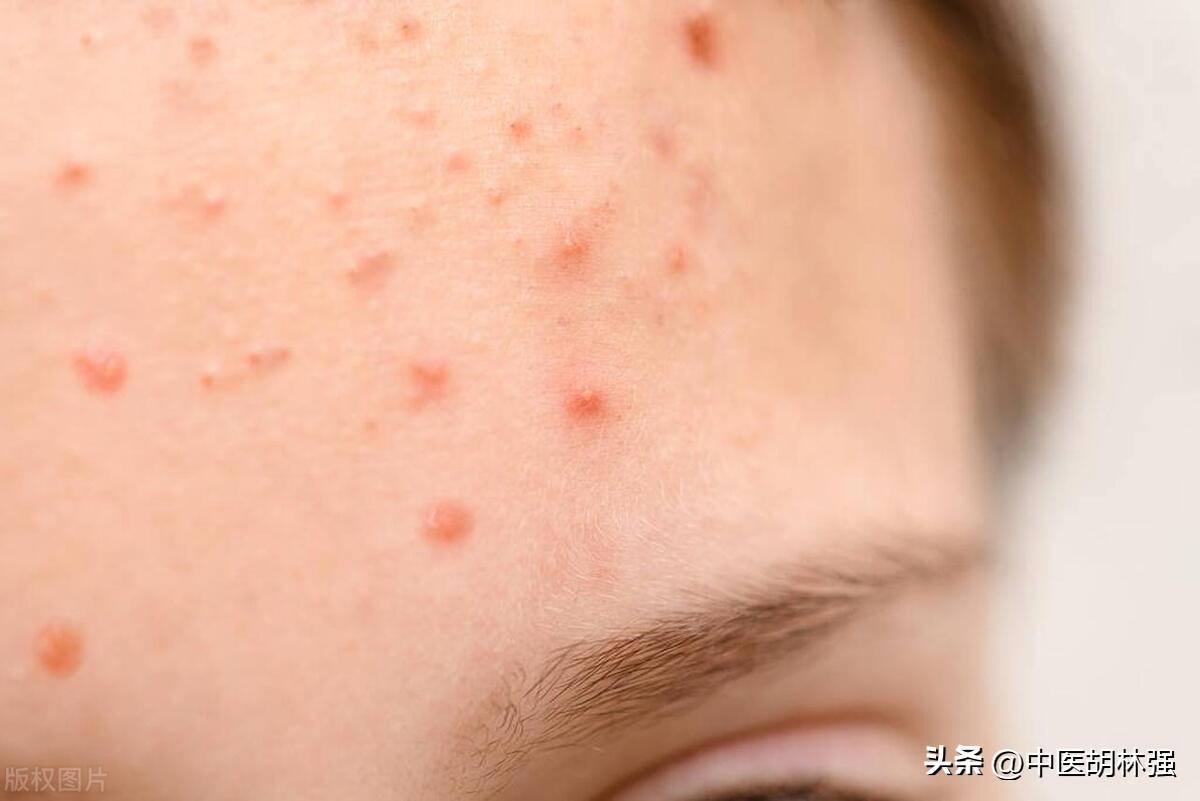 全方位指南 第3頁(yè)