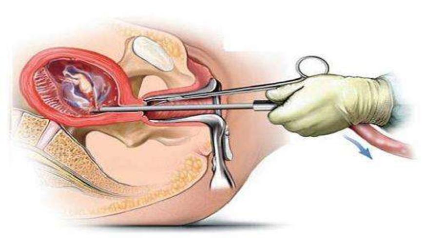 女性如何判斷自己是否不孕,了解征兆與應(yīng)對(duì)之策,女性不孕的征兆與應(yīng)對(duì)策略,判斷、征兆及應(yīng)對(duì)之法