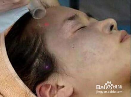 如何有效去除老年斑,全面解析與實用建議,全面解析實用建議,如何有效去除老年斑