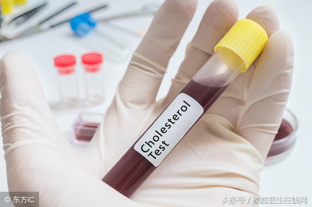 糖尿病的成因,深度解析其背后的原因,深度解析糖尿病成因,揭示背后原因真相