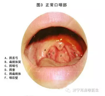 慢性咽炎三天斷根，真相還是幻想？，慢性咽炎三天斷根，真相還是幻想？揭秘治療真相。