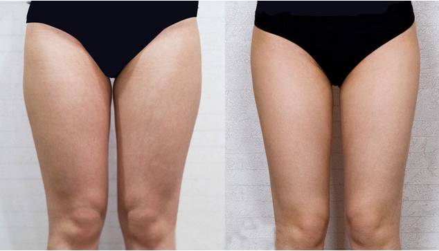 應對策略 第2頁