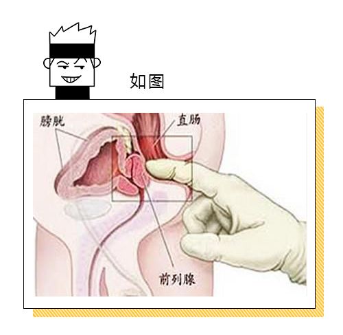 前列腺按摩手法與位置指南,全面解析與實踐,前列腺按摩手法與位置指南,全面解析與實踐技巧
