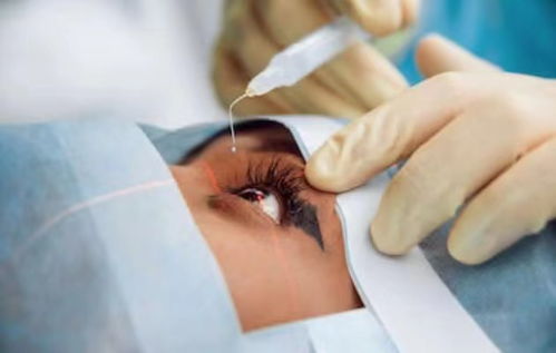 做近視眼手術的危害，全面解析與深度探討，全面解析與深度探討，近視眼手術的危害及風險分析