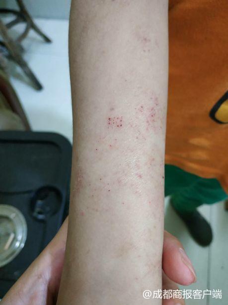 性疾病初期癥狀解析,性疾病初期癥狀深度解析