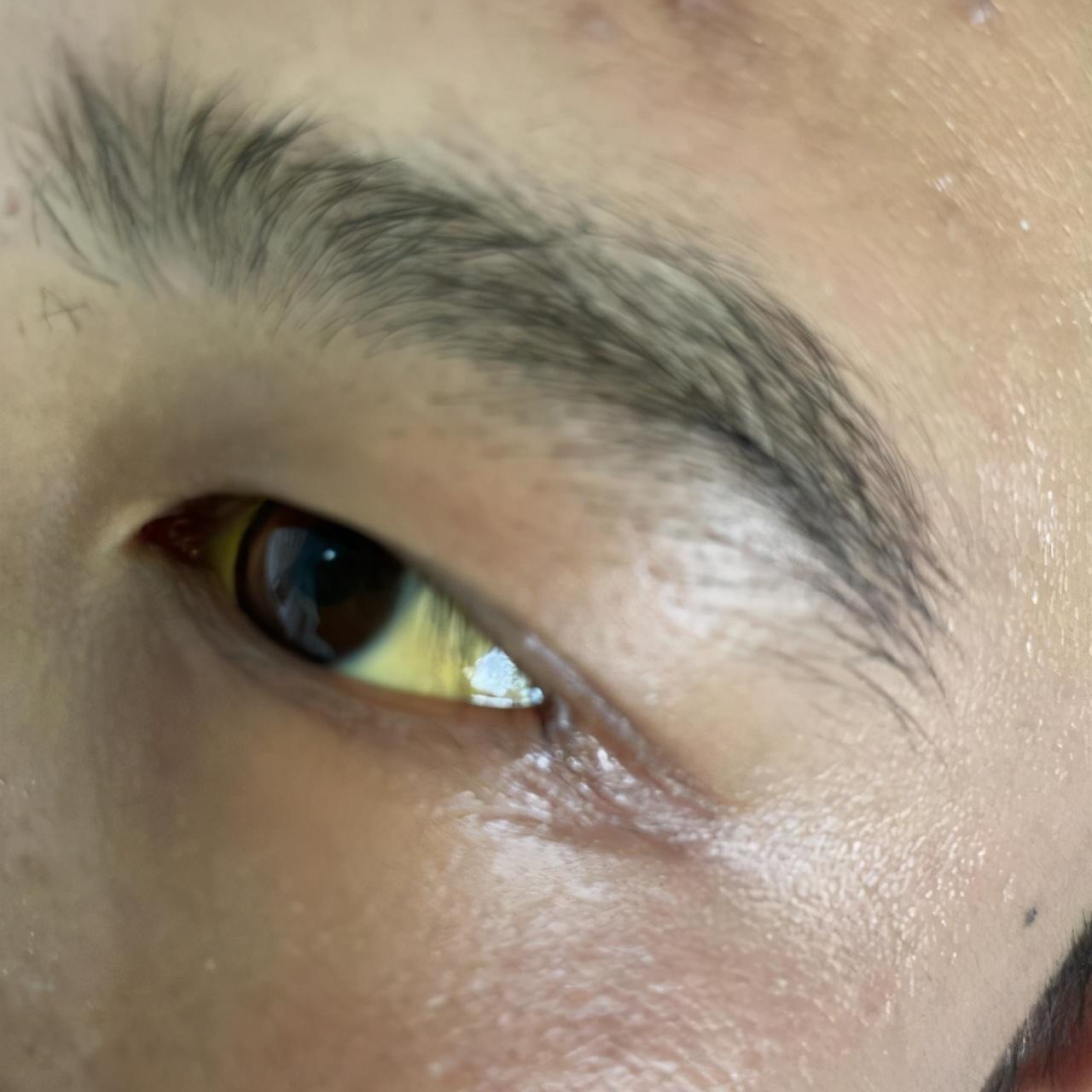 肝功能正常值參考表及其重要性，肝功能正常值參考表，揭示肝臟健康的關(guān)鍵指標(biāo)及其重要性