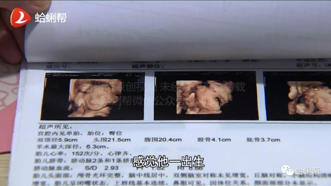 懷孕五個月是否可以終止妊娠?全面解讀風險與選擇,懷孕五個月終止妊娠,風險與選擇全面解讀