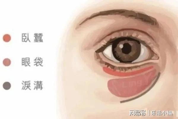 眼袋切除手術費用詳解，價格因素與如何選擇合適的手術方案，眼袋切除手術費用解析，了解價格因素與選擇最佳手術方案